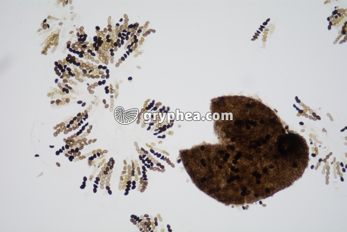 Sordaria asques hybrides x25 - gryphea.com